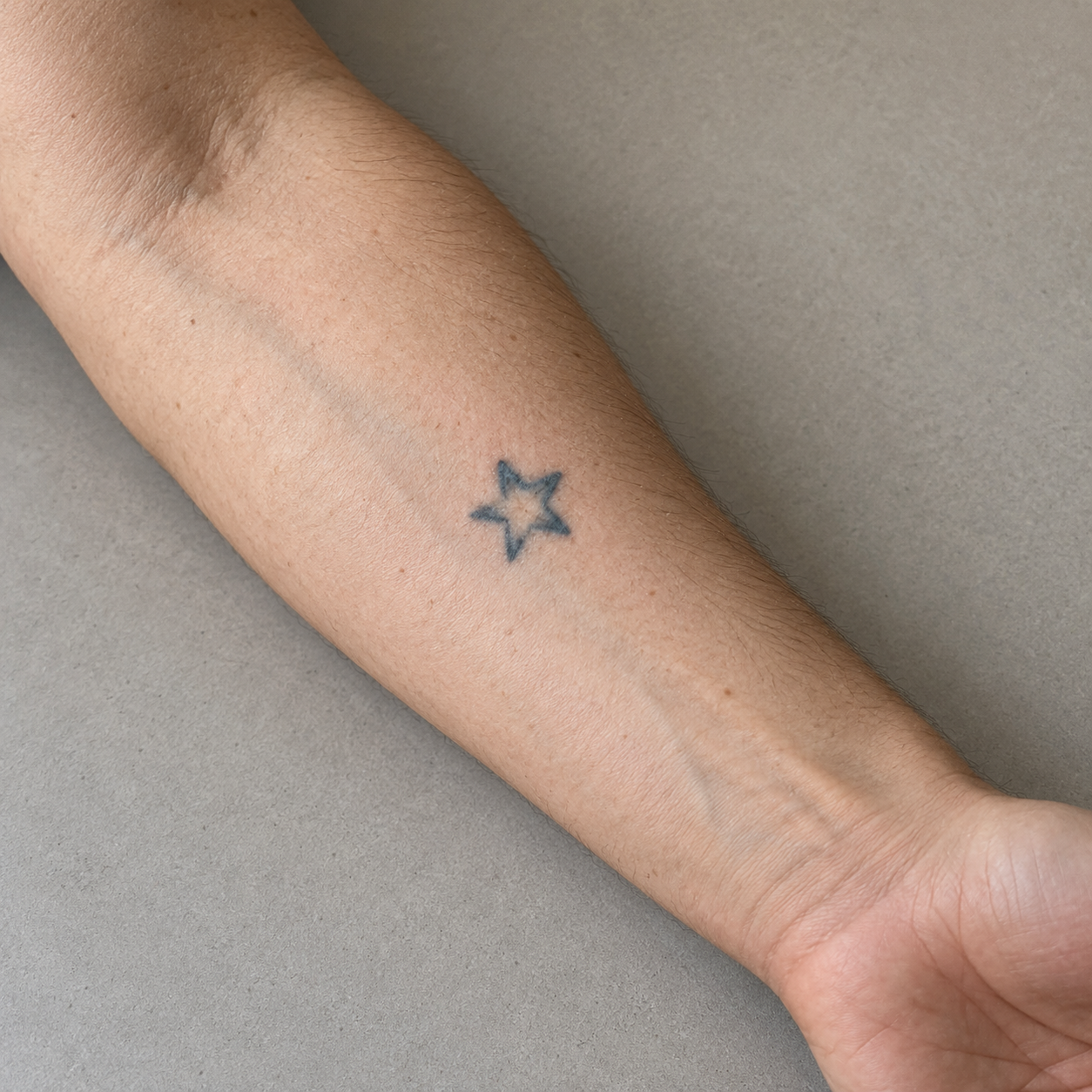 Original synthetic forearm photograph with a faded star tattoo